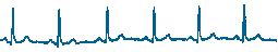 Normal ECG signals